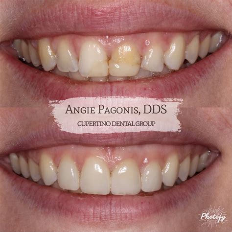 Angie Pagonis, DDS in Cupertino 